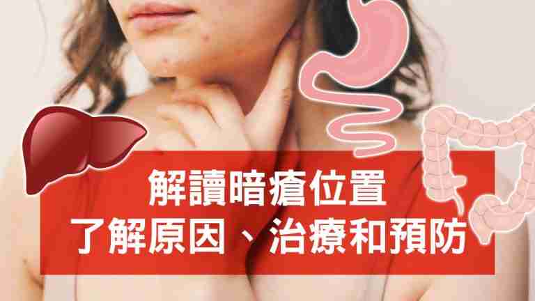 暗瘡位置