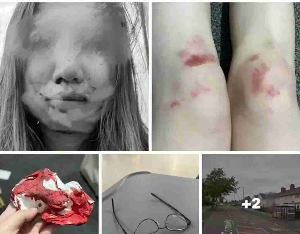 移英港女在英國被打