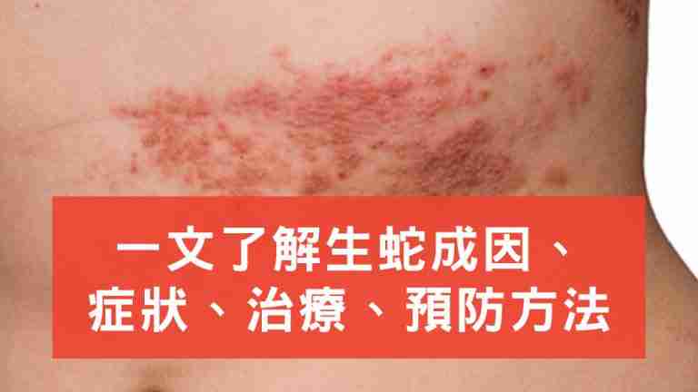 生蛇