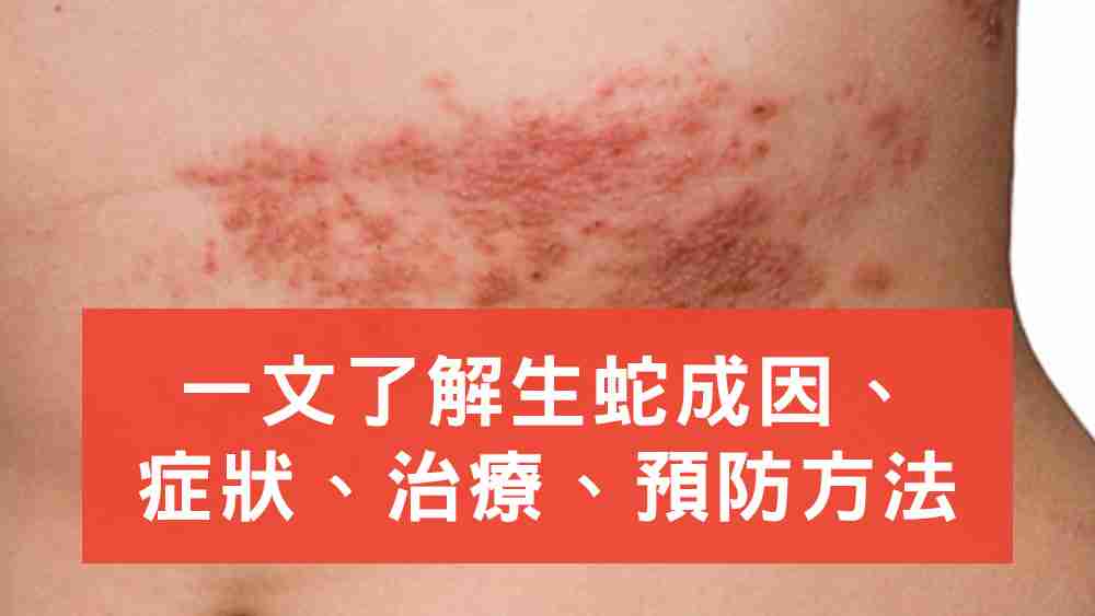 生蛇
