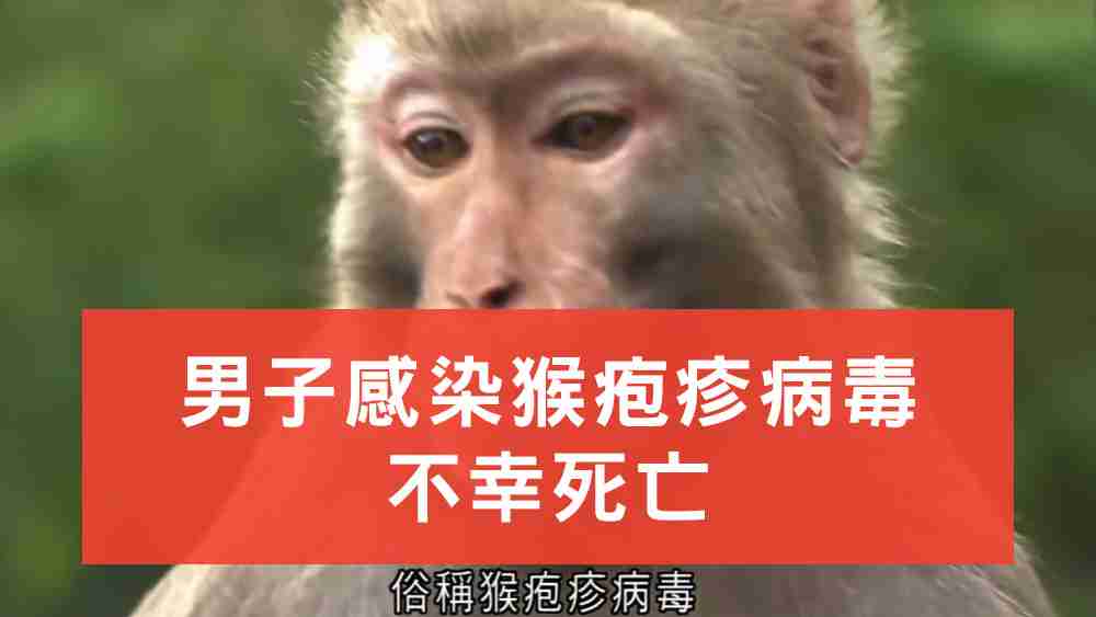 猴疱疹病毒