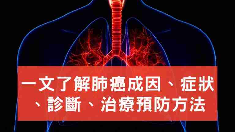肺癌
