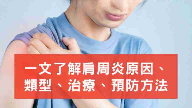 肩周炎