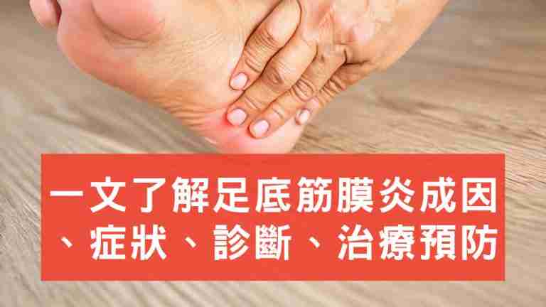 足底筋膜炎