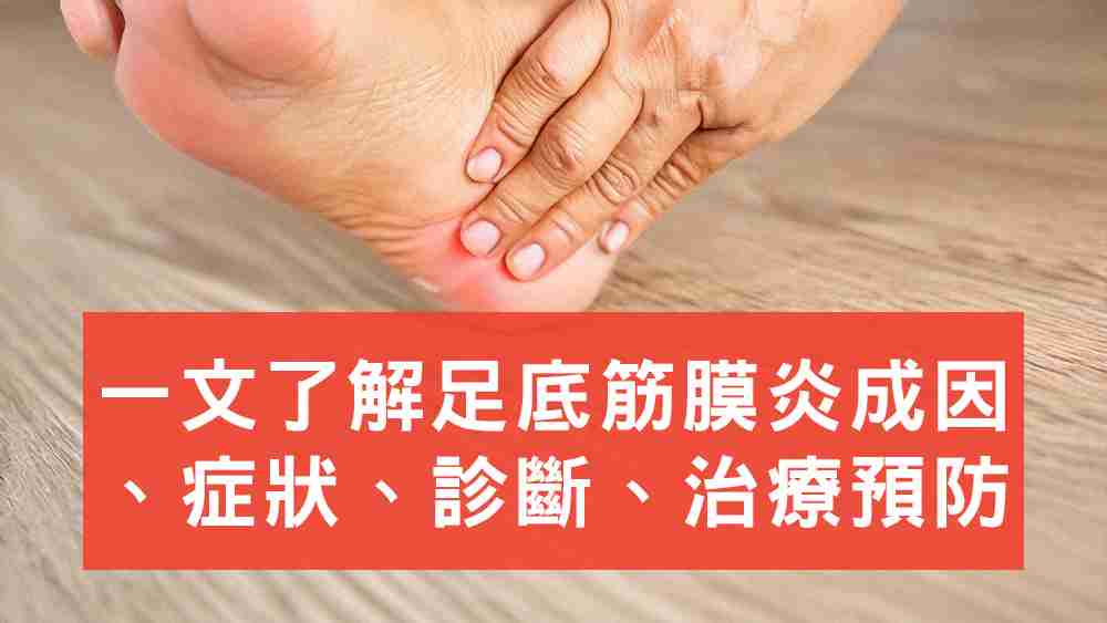 足底筋膜炎