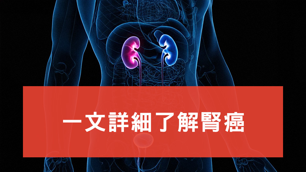 腎癌